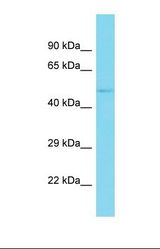 Western blot of Ovary Tumor. GIGYF2 antibody dilution 1.0 ug/ml.