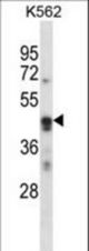 ARC Antibody western blot of K562 cell line lysates (35 ug/lane). The ARC antibody detected the ARC protein (arrow).