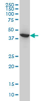 Antibody LS-B6205, Western blot of ACAA2 expression in HeLa.