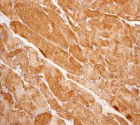 IHC of paraffin-embedded human muscles using anti-ACACB antibody.