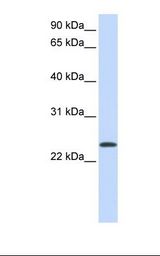 Fetal lung lysate. Antibody concentration: 1.0 ug/ml. Gel concentration: 12%.