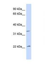 ARF1 antibody LS-C145222 Western blot of Fetal Muscle lysate. Antibody concentration 1 ug/ml.
