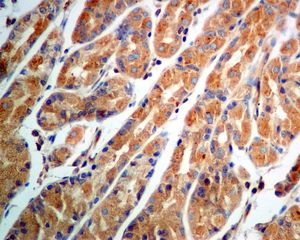 IHC of paraffin-embedded human stomach tissue using anti-ARF3 antibody.
