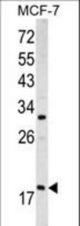 Western blot of ARF3 antibody (Center D93) in MCF-7 cell line lysates (35 ug/lane). ARF3 (arrow) was detected using the purified antibody.