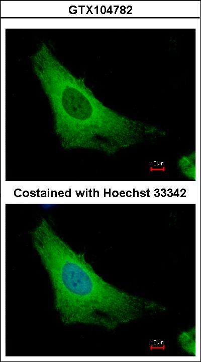 Immunofluorescence of methanol-fixed HeLa using ARF3 antibody at 1:500 dilution.