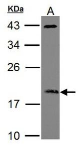 Sample (30 ug of whole cell lysate). A: Raji. 12% SDS PAGE. ADP-ribosylation factor 3 antibody. ARF3 antibody diluted at 1:1000