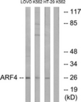 Western blot of extracts from LOVO/K562/HT-29 cells, using ARF4 Antibody. The lane on the right is treated with the synthesized peptide.