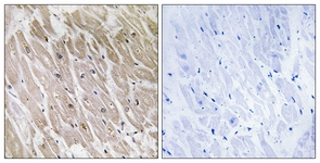 IHC of paraffin-embedded human heart, using ACAD10 Antibody. The picture on the right is treated with the synthesized peptide.