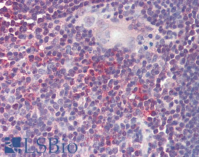 Anti-ARF4 antibody IHC staining of human thymus. Immunohistochemistry of formalin-fixed, paraffin-embedded tissue after heat-induced antigen retrieval. Antibody LS-B9560 concentration 5 ug/ml.