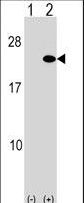 Western blot of ARF5 (arrow) using rabbit polyclonal ARF5 Antibody. 293 cell lysates (2 ug/lane) either nontransfected (Lane 1) or transiently transfected (Lane 2) with the ARF5 gene.