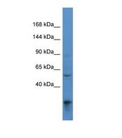 Western blot of Human 293T. ACAD10 antibody dilution 1.0 ug/ml.