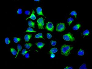 Immunofluorescent staining of HeLa cells using anti-ARF6 antibody.