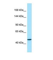Western blot of Human MCF7. ACAD10 antibody dilution 1.0 ug/ml.