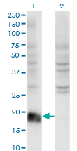 Western Blot analysis of ARF6 expression in transfected 293T cell line by ARF6 monoclonal antibody (M01A), clone 2A4.Lane 1: ARF6 transfected lysate (Predicted MW: 20.1 KDa).Lane 2: Non-transfected lysate.