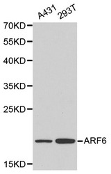 Western blot of ARF6 pAb in extracts from A431 and 293T cells.
