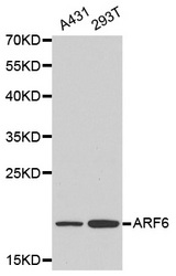 Western blot analysis of A431 cell and 293T cell lysate using ARF6 antibody.