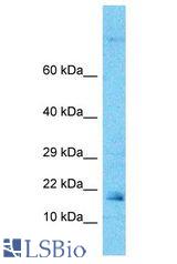 ARF6 antibody Western Blot of MCF7. Antibody dilution: 1 ug/ml.