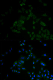 Immunofluorescence analysis of A549 cell using ARF6 antibody. Blue: DAPI for nuclear staining.