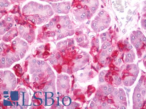 Human Pancreas: Formalin-Fixed, Paraffin-Embedded (FFPE)