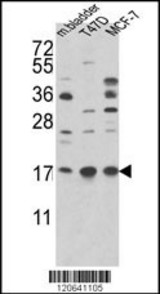 Western blot of ARF6 Antibody (Center) in T47D,MCF-7 cell line and mouse bladder tissue lysates (35 ug/lane). ARF6 (arrow) was detected using the purified Pab.(2 ug/ml)