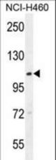 ACD10 Antibody western blot of NCI-H460 cell line lysates (35 ug/lane). The ACD10 antibody detected the ACD10 protein (arrow).
