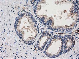 IHC of paraffin-embedded Human prostate tissue using anti-ARFGAP1 mouse monoclonal antibody.