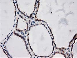 IHC of paraffin-embedded Human thyroid tissue using anti-ARFGAP1 mouse monoclonal antibody.