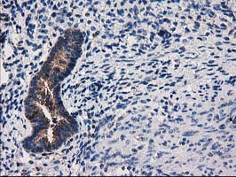 IHC of paraffin-embedded Human endometrium tissue using anti-ARFGAP1 mouse monoclonal antibody.