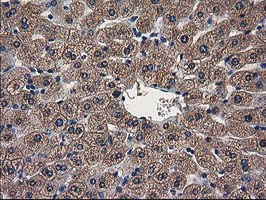 IHC of paraffin-embedded Human liver tissue using anti-ARFGAP1 mouse monoclonal antibody.