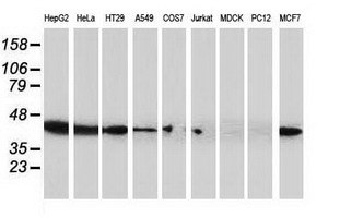 Western blot of extracts (35 ug) from 9 different cell lines by using anti-ARFGAP1 monoclonal antibody.
