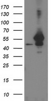 HEK293T cells were transfected with the pCMV6-ENTRY control (Left lane) or pCMV6-ENTRY ARFGAP1 (Right lane) cDNA for 48 hrs and lysed. Equivalent amounts of cell lysates (5 ug per lane) were separated by SDS-PAGE and immunoblotted with anti-ARFGAP1.