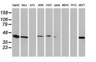 Western blot of extracts (35 ug) from 9 different cell lines by using anti-ARFGAP1 monoclonal antibody.