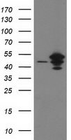HEK293T cells were transfected with the pCMV6-ENTRY control (Left lane) or pCMV6-ENTRY ARFGAP1 (Right lane) cDNA for 48 hrs and lysed. Equivalent amounts of cell lysates (5 ug per lane) were separated by SDS-PAGE and immunoblotted with anti-ARFGAP1.