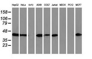 Western blot of extracts (35 ug) from 9 different cell lines by using anti-ARFGAP1 monoclonal antibody.