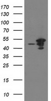 HEK293T cells were transfected with the pCMV6-ENTRY control (Left lane) or pCMV6-ENTRY ARFGAP1 (Right lane) cDNA for 48 hrs and lysed. Equivalent amounts of cell lysates (5 ug per lane) were separated by SDS-PAGE and immunoblotted with anti-ARFGAP1.