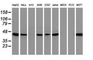 Western blot of extracts (35 ug) from 9 different cell lines by using anti-ARFGAP1 monoclonal antibody.