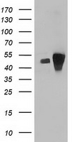 HEK293T cells were transfected with the pCMV6-ENTRY control (Left lane) or pCMV6-ENTRY ARFGAP1 (Right lane) cDNA for 48 hrs and lysed. Equivalent amounts of cell lysates (5 ug per lane) were separated by SDS-PAGE and immunoblotted with anti-ARFGAP1.