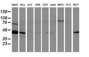 Western blot of extracts (35 ug) from 9 different cell lines by using anti-ARFGAP1 monoclonal antibody.