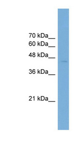 ARFGAP1 antibody LS-C117137 Western blot of Transfected 293T cell lysate.