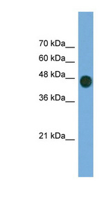 ARFGAP1 antibody LS-C135425 Western blot of Transfected 293T cell lysate.