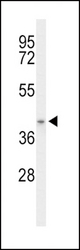 Western blot of ACAD8 Antibody in mouse stomach tissue lysates (35 ug/lane). ACAD8 (arrow) was detected using the purified antibody.