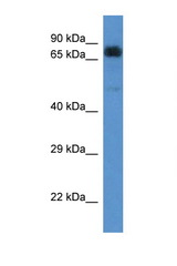 ACAD9 antibody LS-C135883 Western blot of 721_B Cell lysate. Antibody concentration 1 ug/ml.