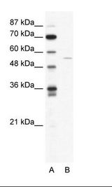 A: Marker, B: HepG2 Cell Lysate