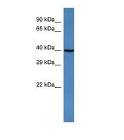 Western blot of Human HeLa. ARFGAP2 antibody dilution 1.0 ug/ml.