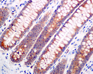 IHC of paraffin-embedded human colon tissue using anti-ARFGAP2 / ZNF289 antibody.