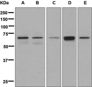 Western blot analysis on (A) fetal liver, (B) human skeletal muscle, (C) HepG2, (D) fetal heart, and (E) HeLa cell lysates using anti-ARFGAP2 / ZNF289 antibody.