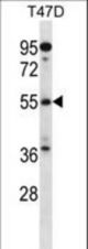 ARFGAP3 Antibody western blot of T47D cell line lysates (35 ug/lane). The ARFGAP3 antibody detected the ARFGAP3 protein (arrow).