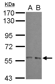 Sample (30 ug of whole cell lysate) A: A549 B: HeLa 7.5% SDS PAGE ARFGAP3 antibody diluted at 1:1000