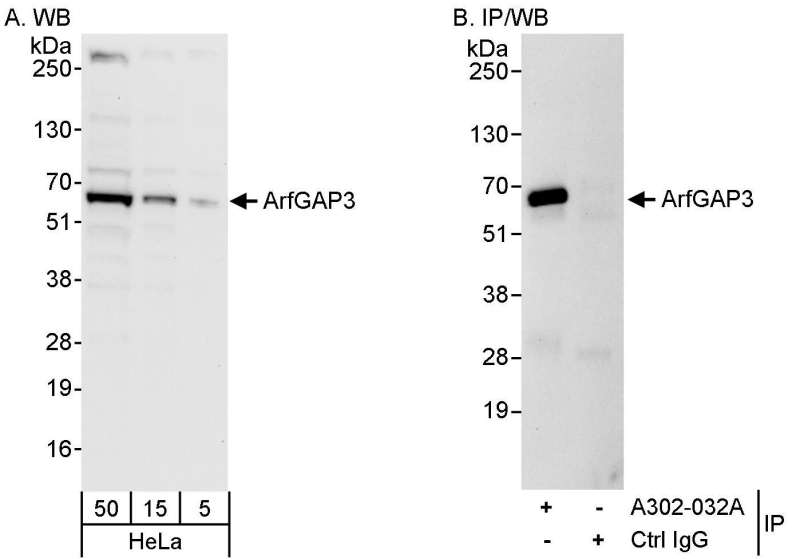 Detection of Human ArfGAP3 by Western Blot and Immunoprecipitation. Samples: Whole cell lysate (5, 15 and 50 ug for WB; 1 mg for IP, 20% of IP loaded) from HeLa cells. Antibody: Affinity purified rabbit anti-ArfGAP3 antibody used for WB at 0.04 ug/ml (A) and 1 ug/ml (B) and used for IP at 3 ug/mg lysate. Detection: Chemiluminescence with exposure times of 30 seconds (A) and 10 seconds (B).