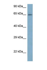 ARFGAP3 antibody LS-C145570 Western blot of 721_B Cell lysate. Antibody concentration 1 ug/ml.